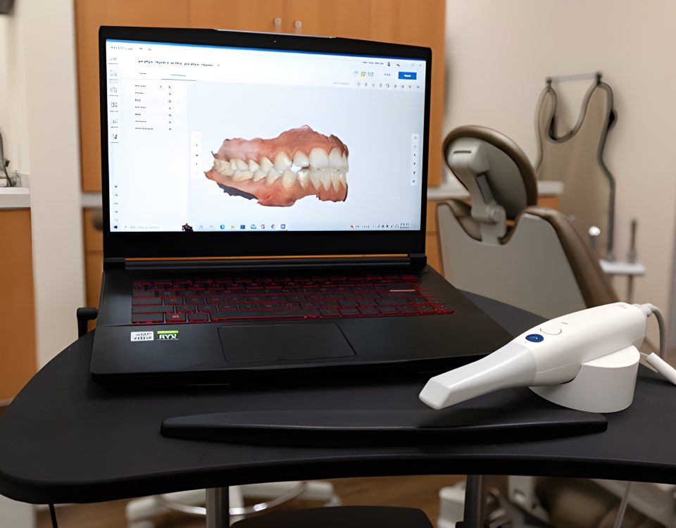 Laptop showing a 3D digital scan of teeth next to an intraoral scanner in a modern dental clinic